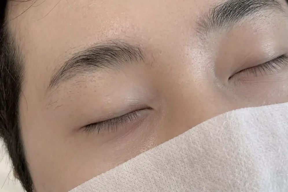 Why is my Microblading so dark at first?